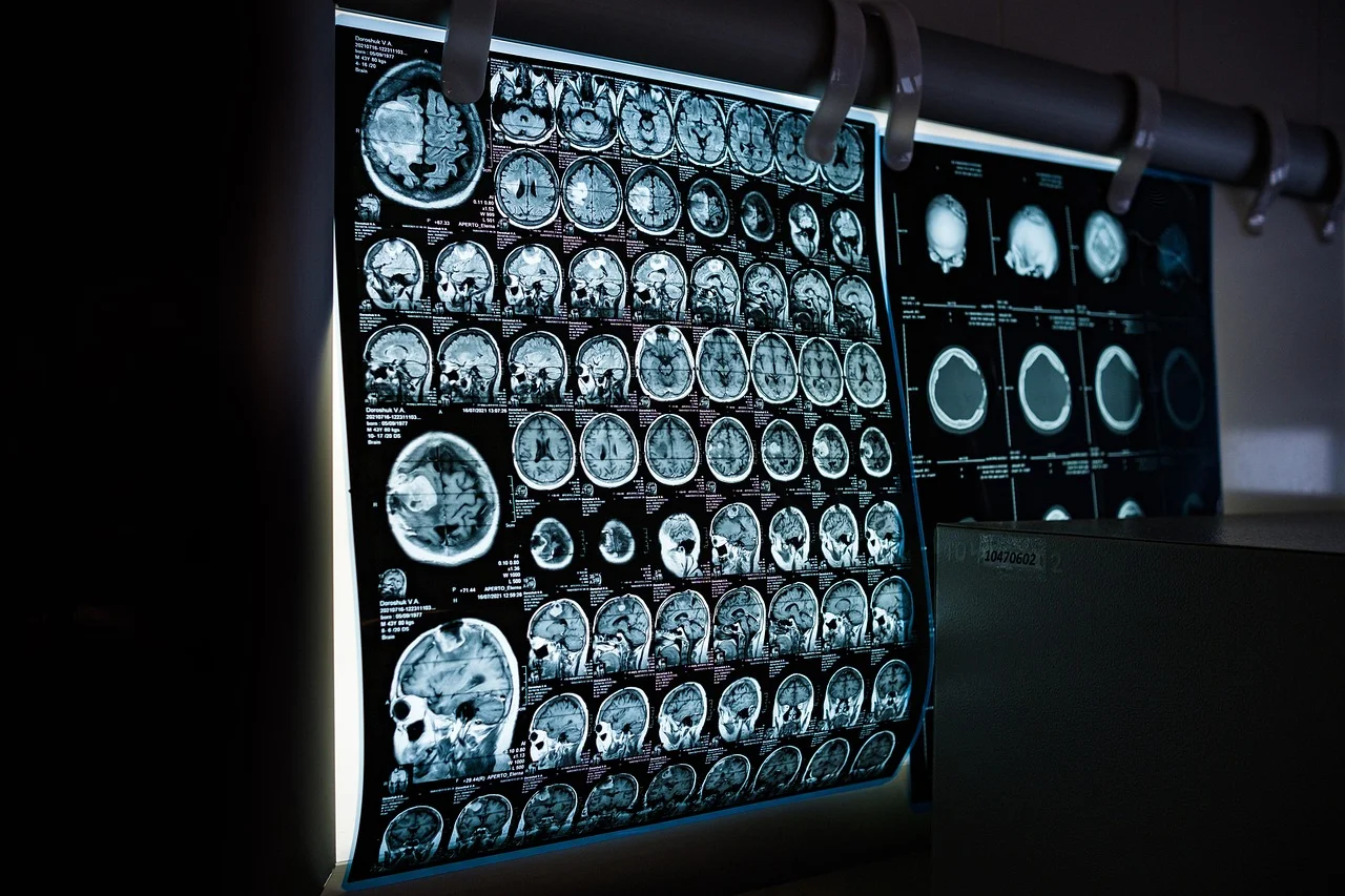 Rezonans magnetyczny prywatnie – bezpieczna diagnostyka w Rakoniewicach
